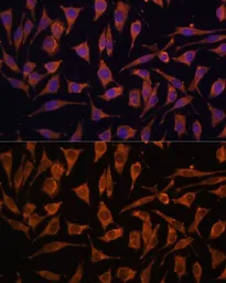 Anti-NDUFA4L2 antibody used in Immunocytochemistry/ Immunofluorescence (ICC/IF). GTX66244