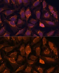 Anti-NDUFA4L2 antibody used in Immunocytochemistry/ Immunofluorescence (ICC/IF). GTX66244