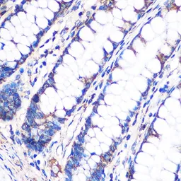 Anti-NDUFA4L2 antibody used in IHC (Paraffin sections) (IHC-P). GTX66244