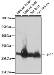 Anti-LHPP antibody used in Western Blot (WB). GTX66250