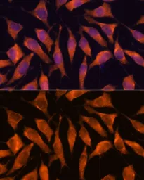 Anti-LHPP antibody used in Immunocytochemistry/ Immunofluorescence (ICC/IF). GTX66250