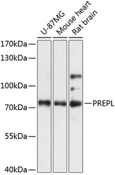 Anti-PREPL antibody used in Western Blot (WB). GTX66252