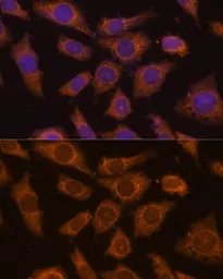 Anti-PREPL antibody used in Immunocytochemistry/ Immunofluorescence (ICC/IF). GTX66252