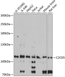 Anti-C2CD5 antibody used in Western Blot (WB). GTX66253