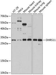Anti-DHRS11 antibody used in Western Blot (WB). GTX66257