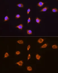 Anti-Thyrotropin releasing hormone antibody used in Immunocytochemistry/ Immunofluorescence (ICC/IF). GTX66259