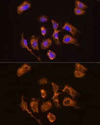 Anti-Thyrotropin releasing hormone antibody used in Immunocytochemistry/ Immunofluorescence (ICC/IF). GTX66259