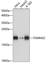 Anti-TOMM22 antibody used in Western Blot (WB). GTX66265