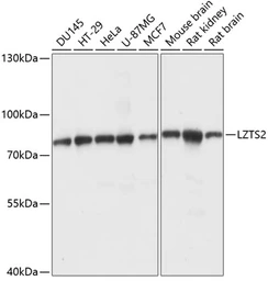 Anti-LZTS2 antibody used in Western Blot (WB). GTX66271