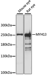 Anti-MYH13 antibody used in Western Blot (WB). GTX66275
