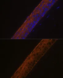 Anti-MYH13 antibody used in IHC (Paraffin sections) (IHC-P). GTX66275