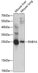 Anti-Rab 1A antibody used in Western Blot (WB). GTX66279