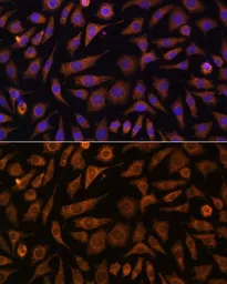 Anti-Rab 1A antibody used in Immunocytochemistry/ Immunofluorescence (ICC/IF). GTX66279