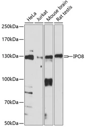 Anti-Importin 8 antibody used in Western Blot (WB). GTX66280