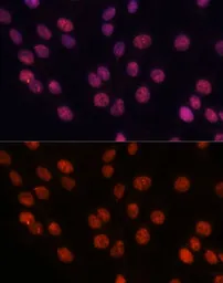 Anti-Importin 8 antibody used in Immunocytochemistry/ Immunofluorescence (ICC/IF). GTX66280