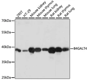 Anti-B4GALT4 antibody used in Western Blot (WB). GTX66282
