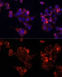 Anti-B4GALT4 antibody used in Immunocytochemistry/ Immunofluorescence (ICC/IF). GTX66282
