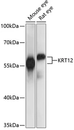 Anti-Cytokeratin 12 antibody used in Western Blot (WB). GTX66286