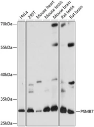 Anti-Proteasome 20S beta 7 antibody used in Western Blot (WB). GTX66287