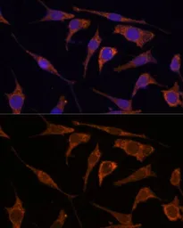 Anti-RPE antibody used in Immunocytochemistry/ Immunofluorescence (ICC/IF). GTX66288