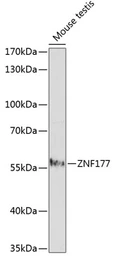 Anti-ZNF177 antibody used in Western Blot (WB). GTX66290