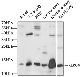 Anti-KLRC4 antibody used in Western Blot (WB). GTX66291