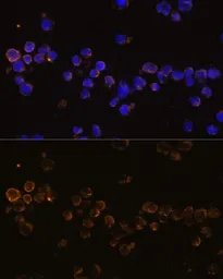 Anti-KLRC4 antibody used in Immunocytochemistry/ Immunofluorescence (ICC/IF). GTX66291