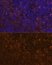 Anti-KLRC4 antibody used in IHC (Paraffin sections) (IHC-P). GTX66291