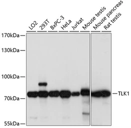 Anti-TLK1 antibody used in Western Blot (WB). GTX66297