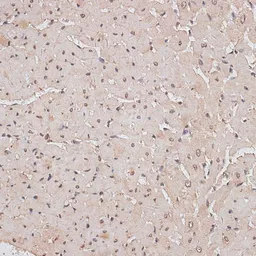 Anti-TLK1 antibody used in IHC (Paraffin sections) (IHC-P). GTX66297