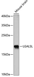 Anti-HSPC159 antibody used in Western Blot (WB). GTX66304