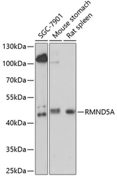 Anti-RMND5A antibody used in Western Blot (WB). GTX66310