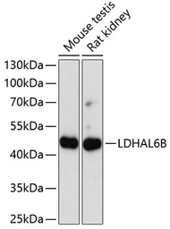 Anti-LDHAL6B antibody used in Western Blot (WB). GTX66312