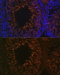 Anti-LDHAL6B antibody used in IHC (Paraffin sections) (IHC-P). GTX66312