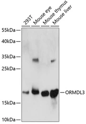 Anti-ORMDL3 antibody used in Western Blot (WB). GTX66313