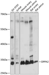 Anti-Dppa2 antibody used in Western Blot (WB). GTX66315