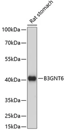 Anti-B3GNT6 antibody used in Western Blot (WB). GTX66316