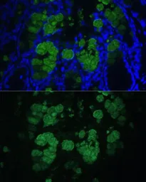 Anti-CLCA1 antibody used in IHC (Paraffin sections) (IHC-P). GTX66323