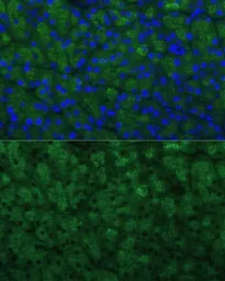 Anti-CTRB1 antibody used in IHC (Paraffin sections) (IHC-P). GTX66324