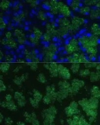 Anti-CTRB1 antibody used in IHC (Paraffin sections) (IHC-P). GTX66324