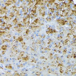 Anti-CTRB1 antibody used in IHC (Paraffin sections) (IHC-P). GTX66324