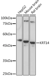 Anti-Cytokeratin 14 antibody used in Western Blot (WB). GTX66326