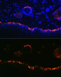 Anti-Cytokeratin 14 antibody used in IHC (Paraffin sections) (IHC-P). GTX66326