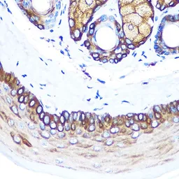Anti-Cytokeratin 14 antibody used in IHC (Paraffin sections) (IHC-P). GTX66326