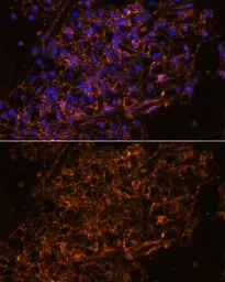 Anti-ENaC Gamma antibody used in IHC (Paraffin sections) (IHC-P). GTX66332