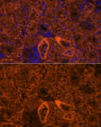 Anti-ENaC Gamma antibody used in IHC (Paraffin sections) (IHC-P). GTX66332