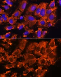 Anti-XK antibody used in Immunocytochemistry/ Immunofluorescence (ICC/IF). GTX66333
