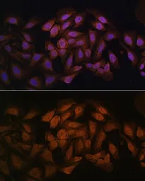 Anti-CNBP antibody used in Immunocytochemistry/ Immunofluorescence (ICC/IF). GTX66334