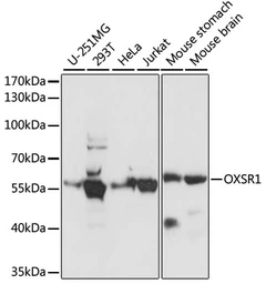Anti-OXSR1 antibody used in Western Blot (WB). GTX66335