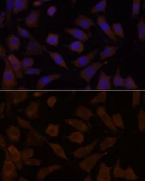 Anti-OXSR1 antibody used in Immunocytochemistry/ Immunofluorescence (ICC/IF). GTX66335